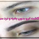 کاشت ابرو بدون بخیه و درد سر