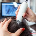 اسکالپ تریتمنت چگونه باعث رشد مجدد مو می شود؟